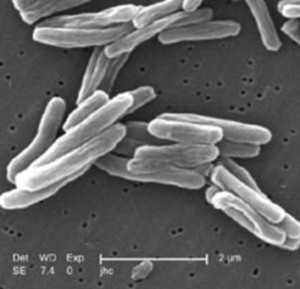 Mycobacterium tuberculosis (TB) bacteria seen under scanning electron microscope (x15000)