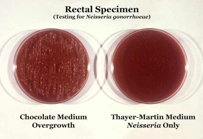 Neisseria gonorrhoeae bacteria