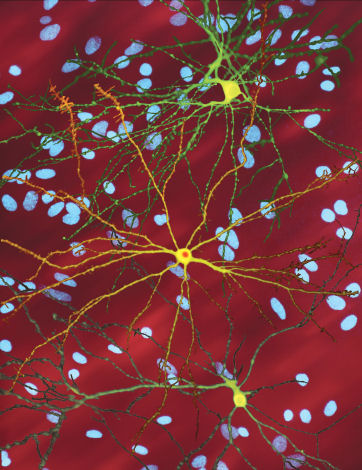 Neurons with mHtt inclusion