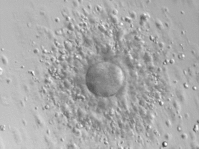 Human oocyte (egg cell) with surrounding granulosa cells, after aspiration