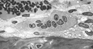 Osteoclast displaying many nuclei within its 