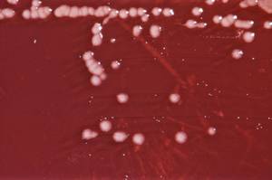Pseudomonas aeruginosa bacterial culture on an Xylose Lysine Sodium Deoxycholate (XLD) agar plate.
