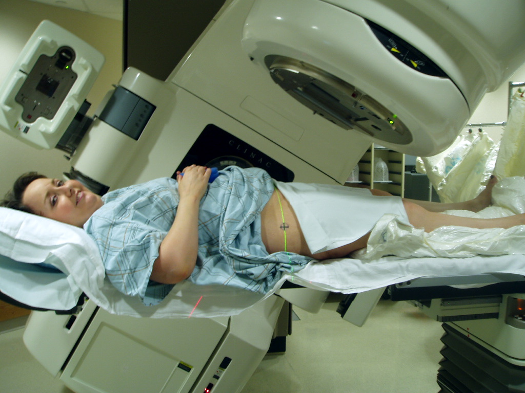 Radiation therapy of the pelvis. Lasers and a mould under the legs are used to determine exact position.