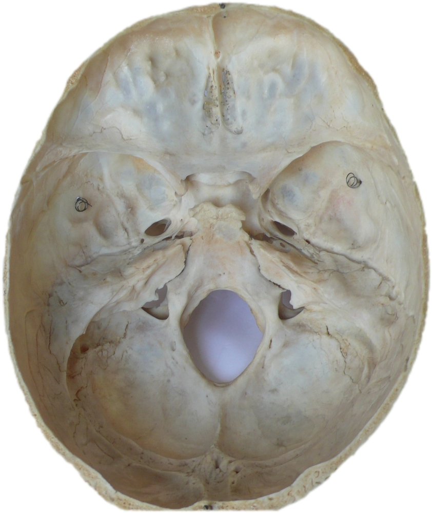 Human Neurocranium - Good Bowl?