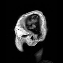An animated gif of MRI images of a human head.