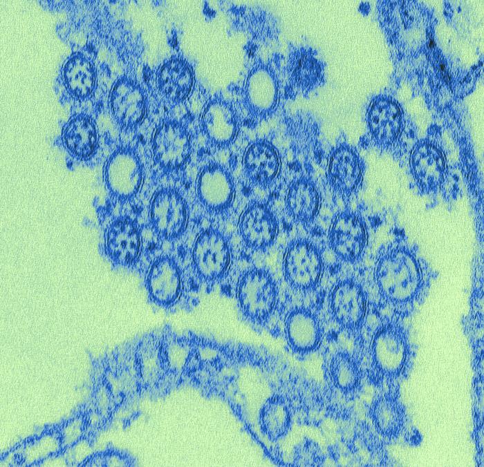 Virus 1