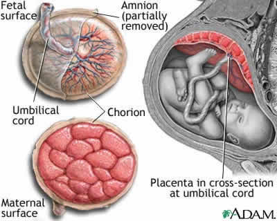 Figure 3 - The position and appearance of the placenta in situ, and after delivery. Image © ADAM.com