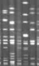 Genetic Fingerprints - DNA can be cut into shorter pieces by enzymes called 