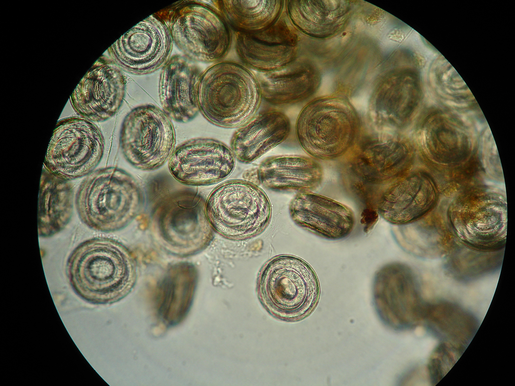 Myrmeconema neotropicum parasite eggs