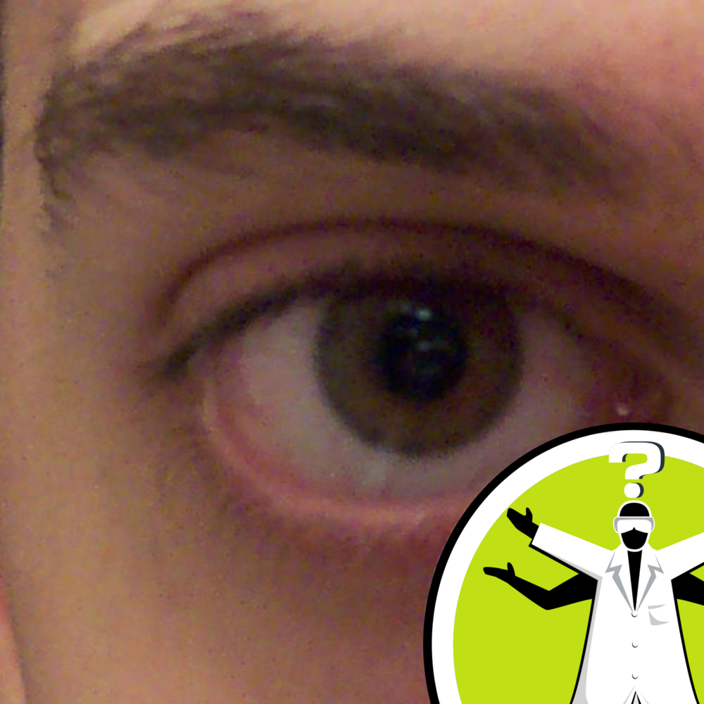 Why do people get bags under their eyes?
