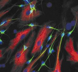Figure 2 : Nerve cells (neurones in green, astrocytes in red) generated from neural stem cells grown in cell culture.