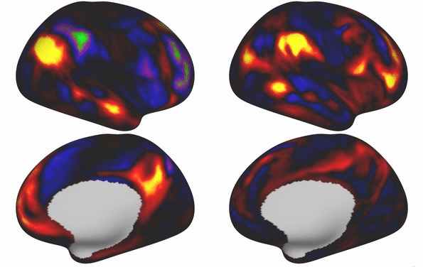 The shape and exact location of certain brain regions is linked to intelligence, life satisfaction and other behavioural factors.