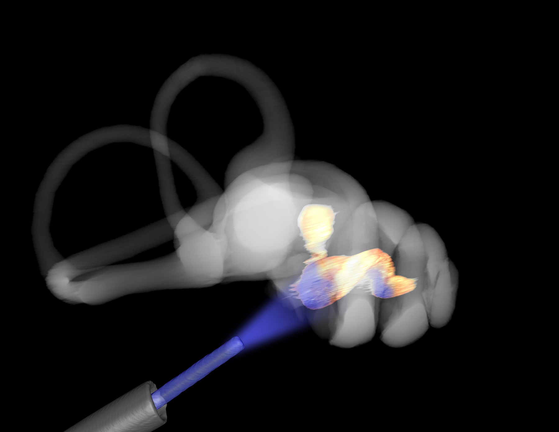 Deaf adult gerbils can hear again with optogenetic hearing restoration. 