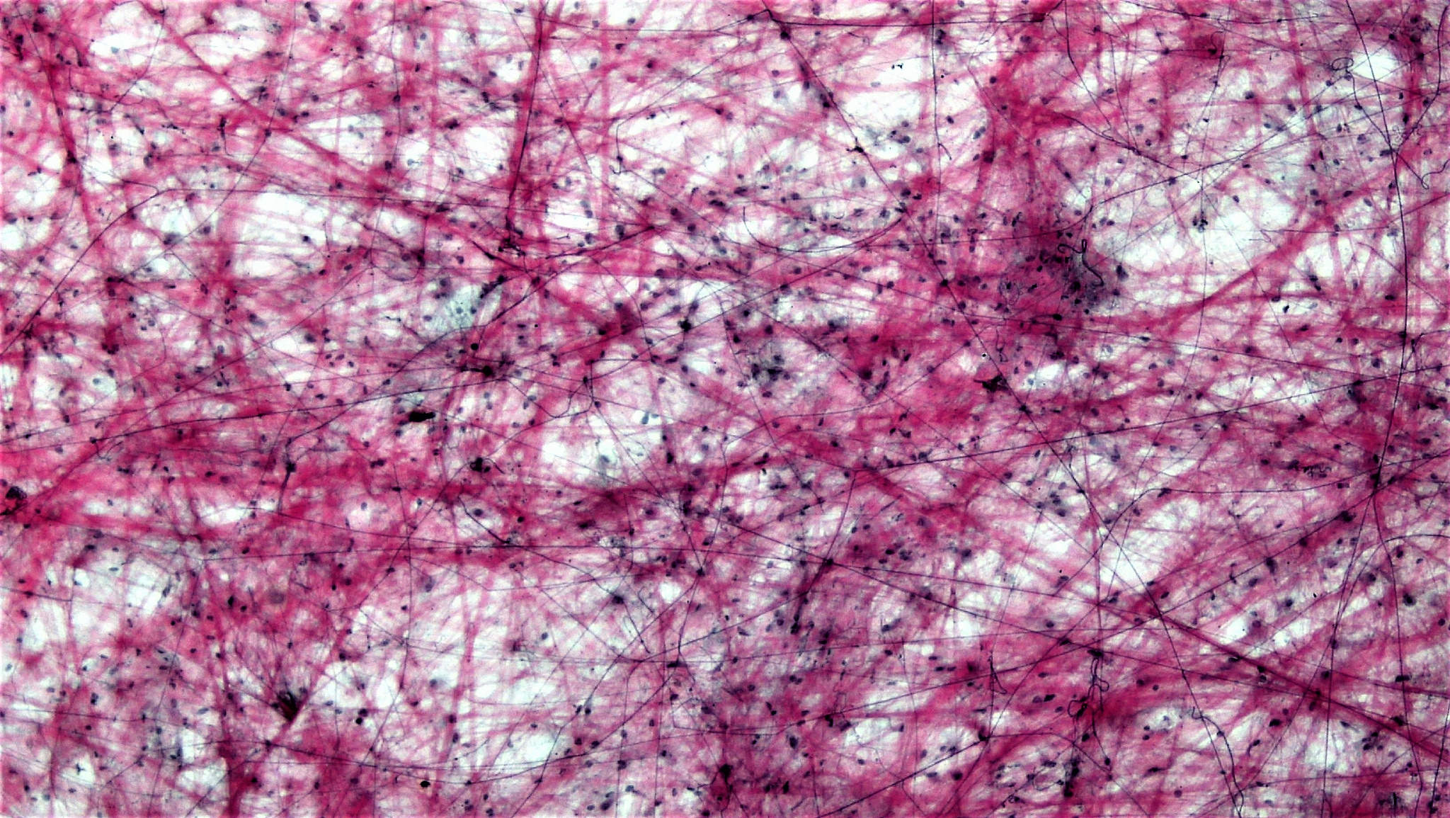 Connective Tissue: Loose Areolar
