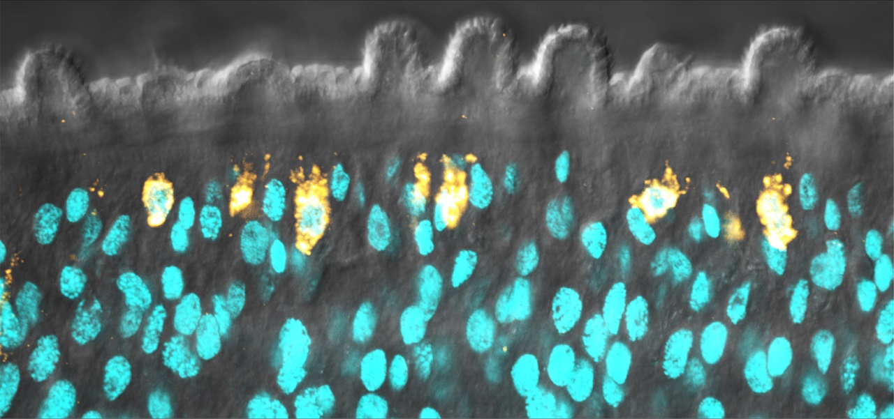 Schistosome stem cells