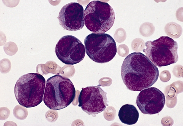 Myeloid Leukaemia cells