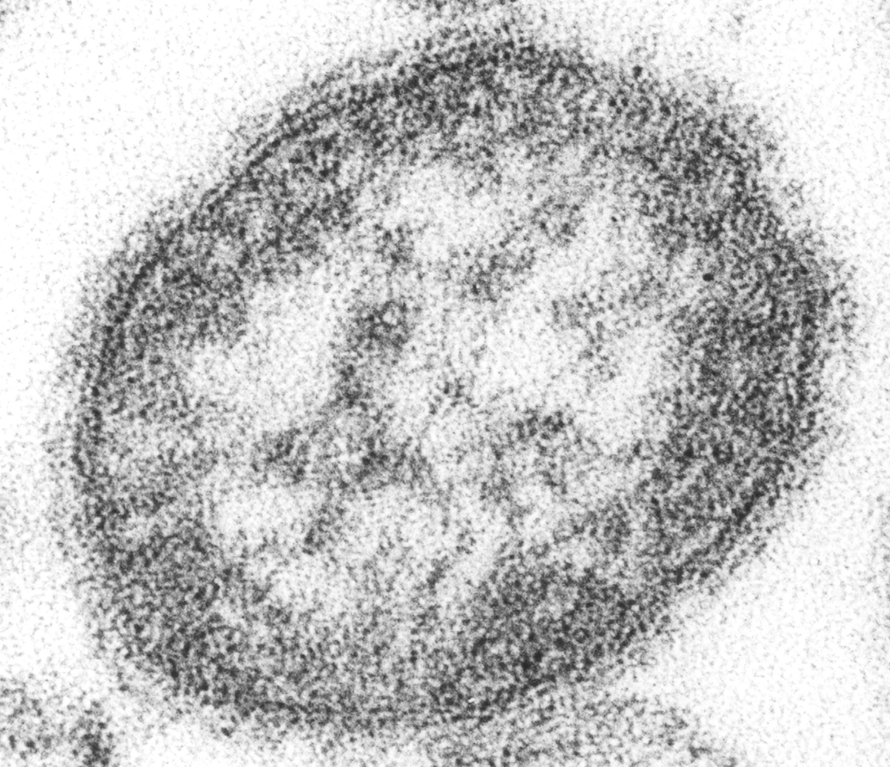 A measles virus particle (virion). The measles virus is a paramyxovirus, of the genus Morbillivirus. It is 100-200 nm in diameter, with a core of single-stranded RNA, and is closely related to the rinderpest and canine distemper viruses.