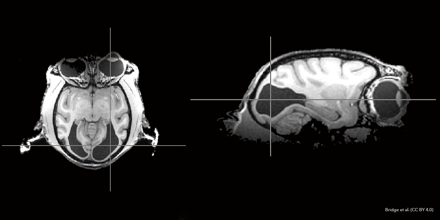 Brain scan of a monkey that could still see but lacked a primary visual cortex