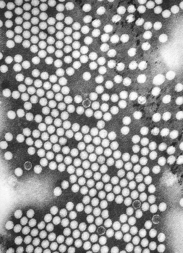 Electron micrograph of the poliovirus. Poliovirus is a species of Enterovirus, which is a Genus in the family of Picornaviridae, and is an RNA virus.