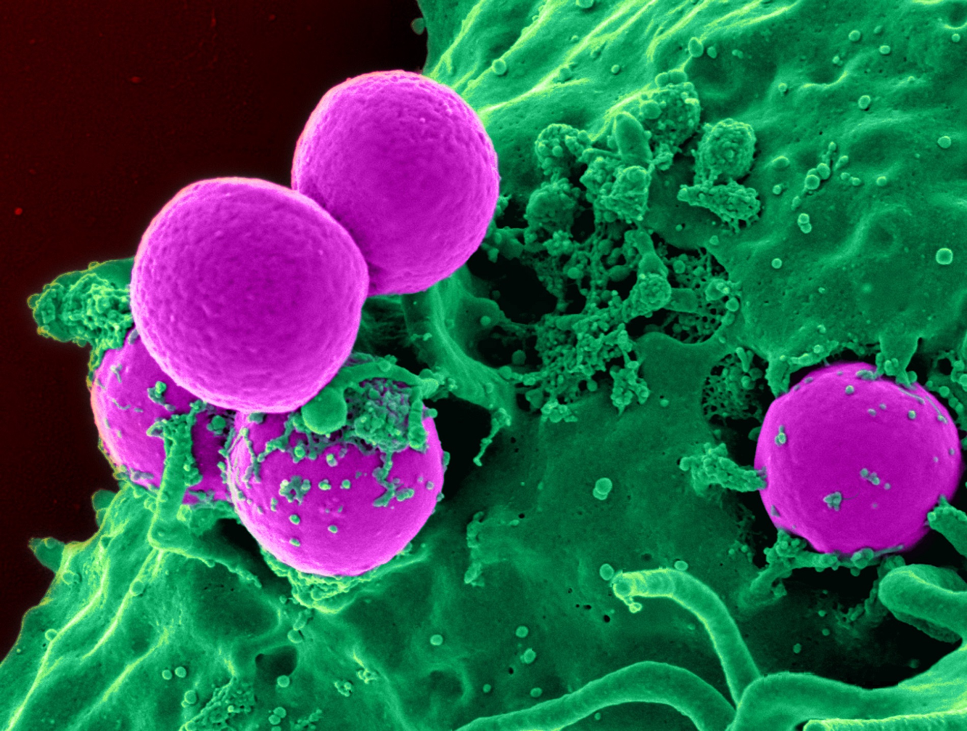 White blood cells