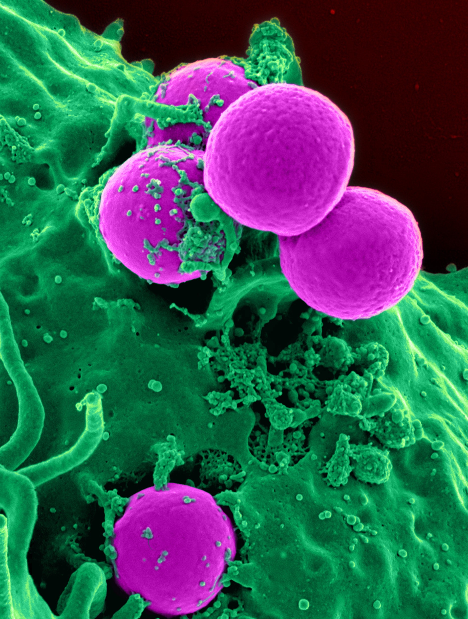 Immune cells