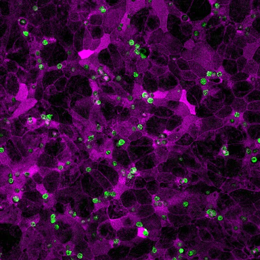 Parasite cryptosporidium