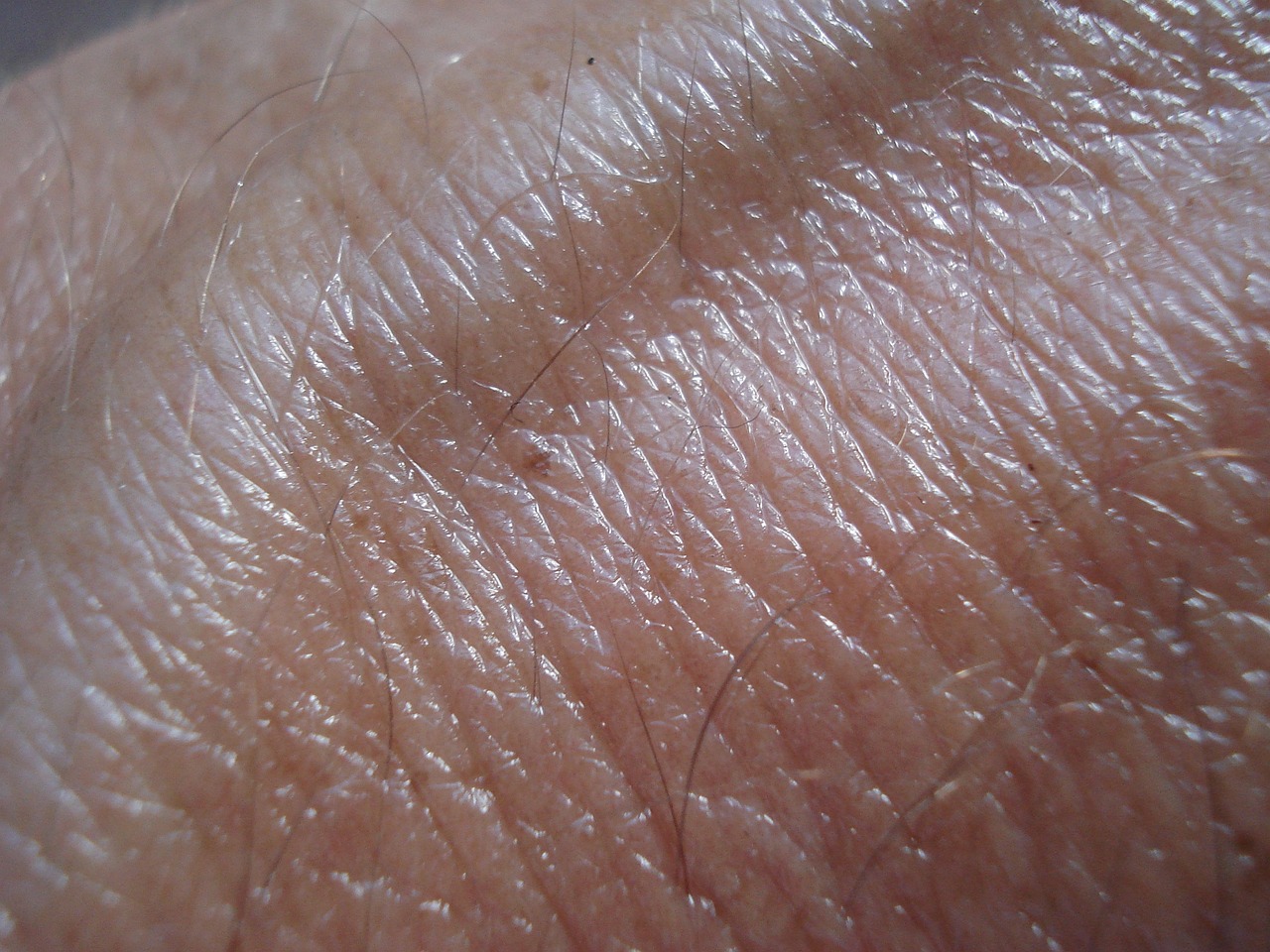 Skin close up