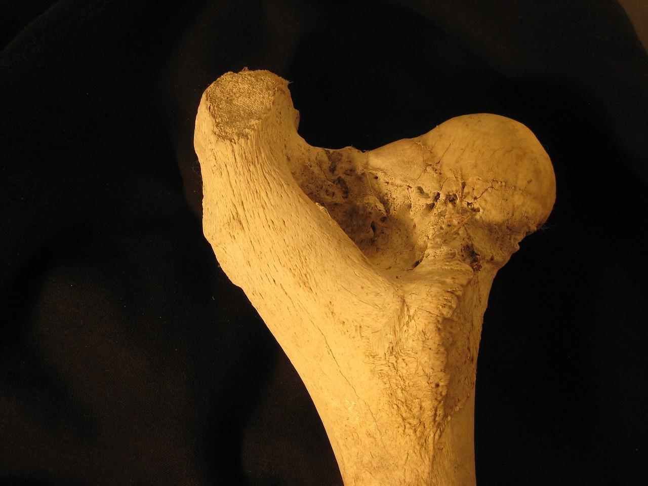 femur bone