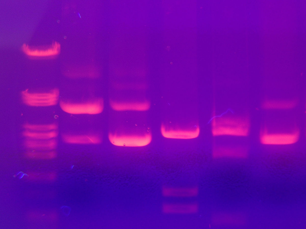 Bands of DNA