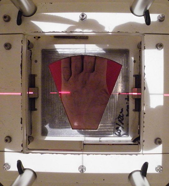  Shows the beam's eye view of the radiotherapy portal.