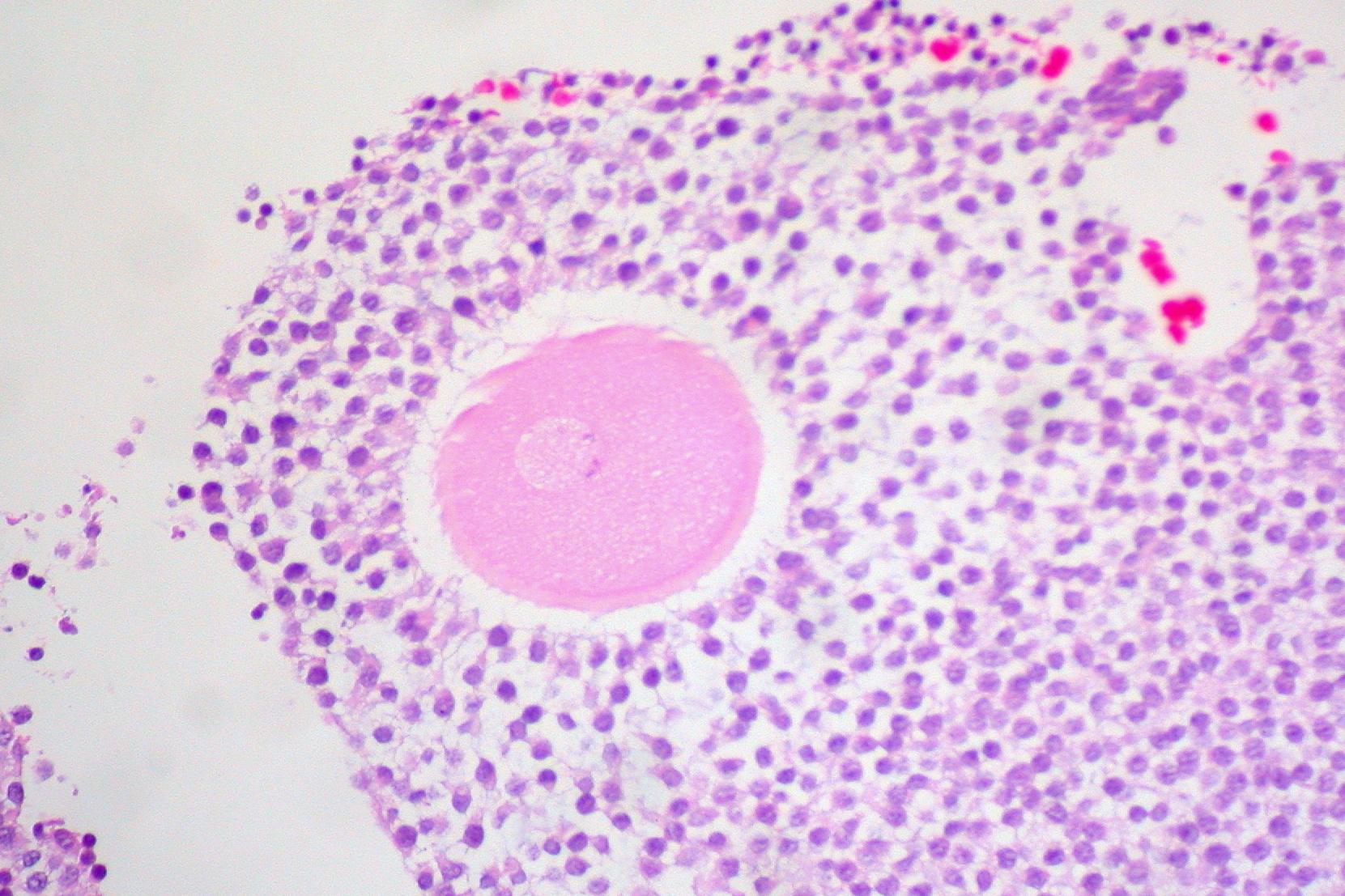 A human egg cell