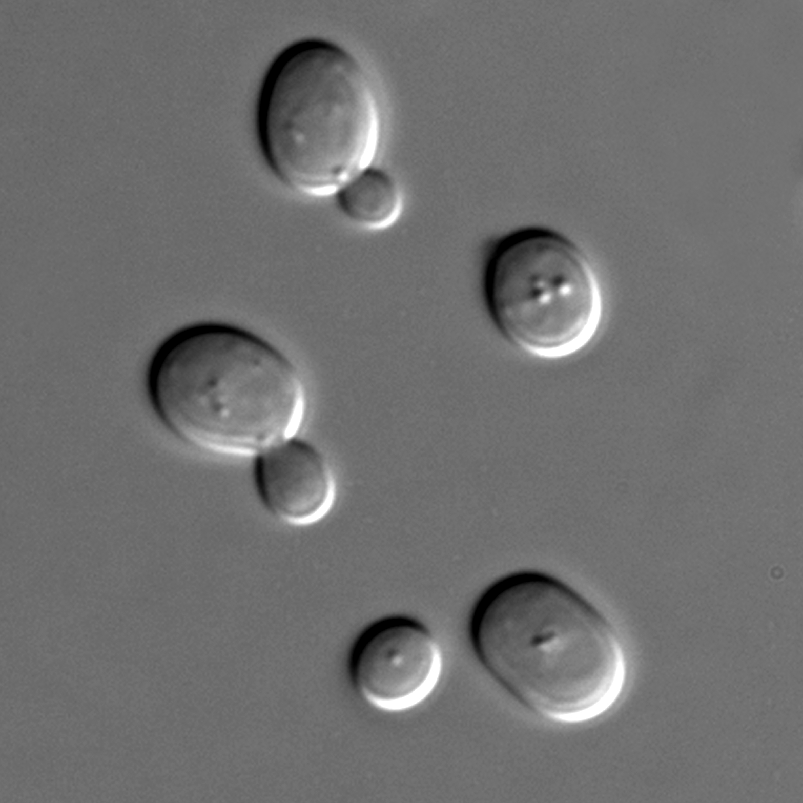 Saccharomyces cerevisiae cells in DIC microscopy.