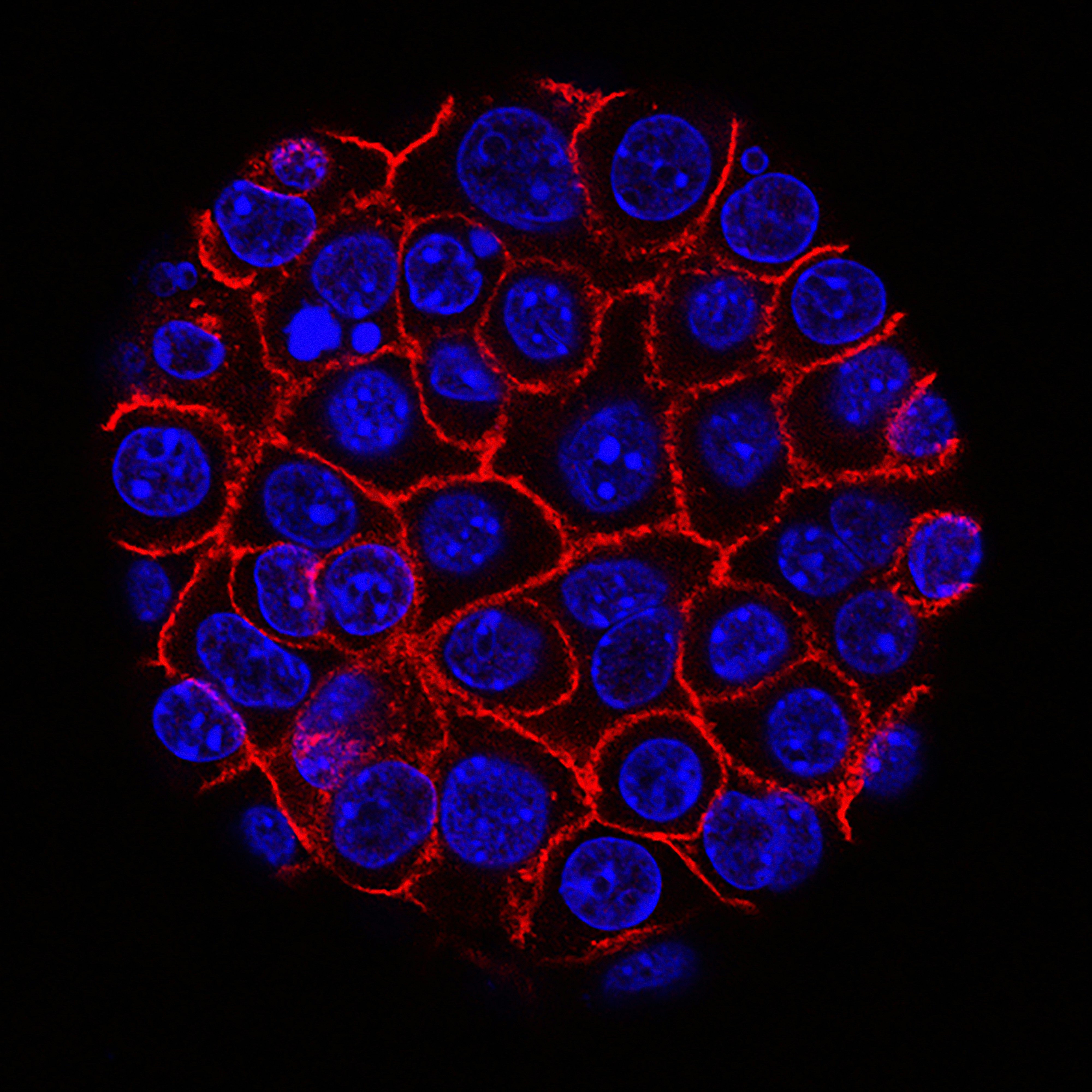 Pancreatic cancer cell