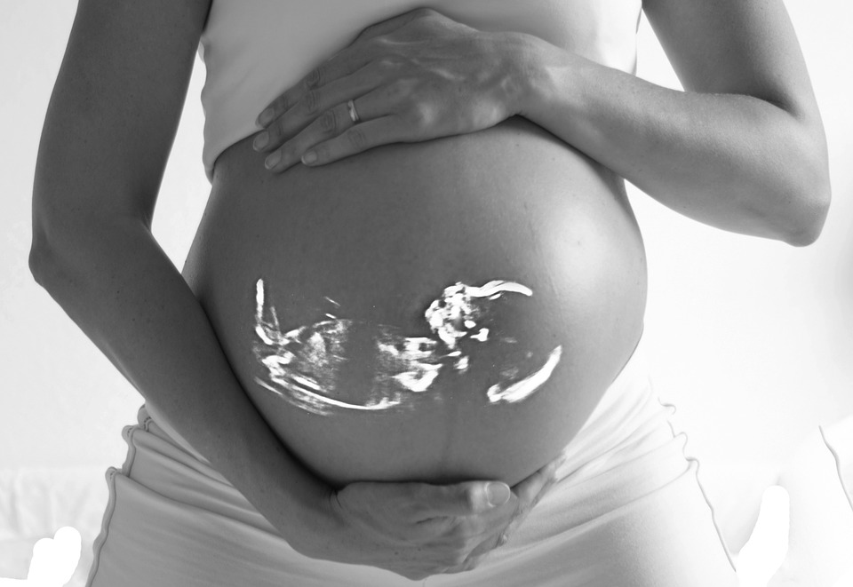 Ultrasound on pregnant lady