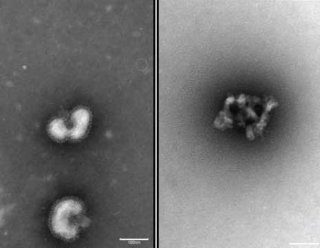Side by side before and after images when intact flu virus particles (left) are exposed to urumin, triggering their destruction (right).