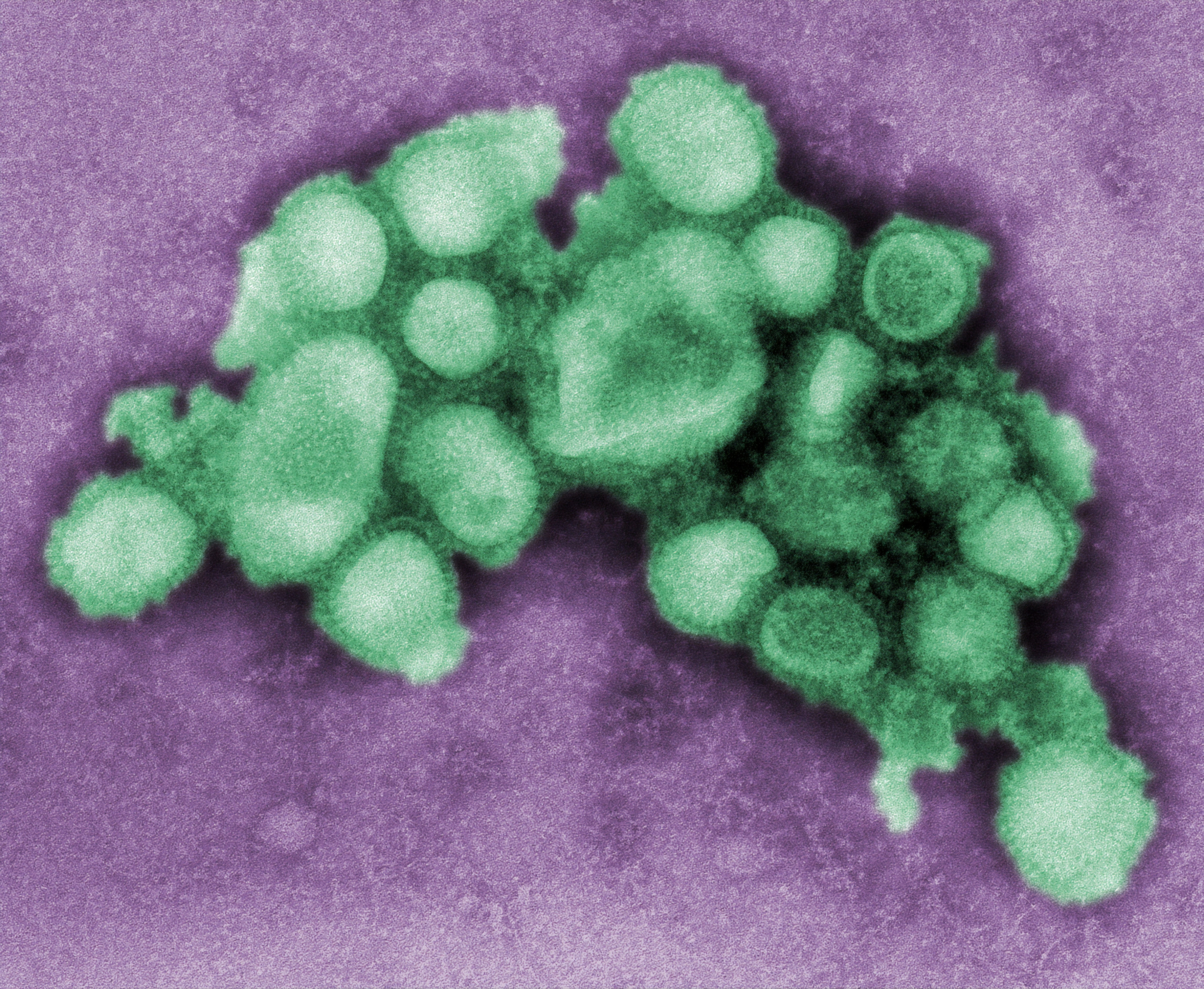 Influenza virus particles