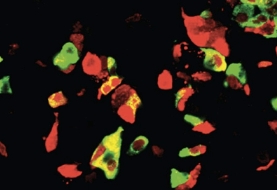 Generating different types of hormone secreting cells from human tissue sources could lead to new treatments for diabetes.
