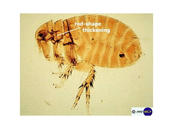 Plague infected rat flea by Michael Wunderli