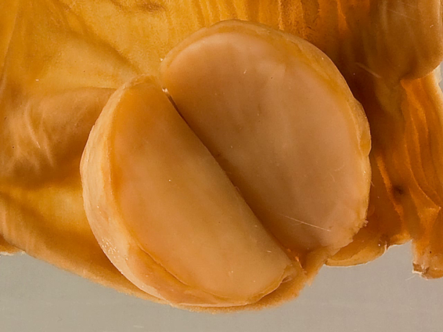 Tumour of the small intestine
