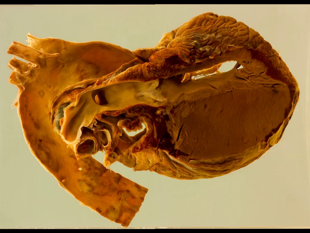 Dextrocardia