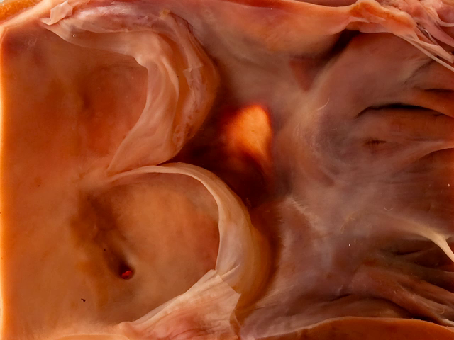 Membranous septum