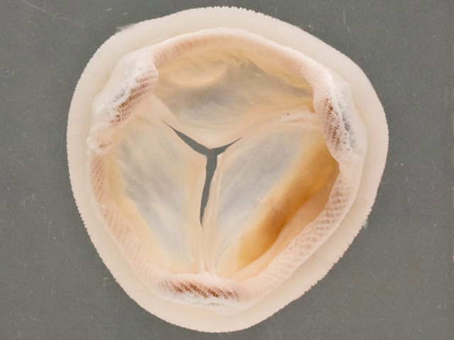 Porcine heterograft valve