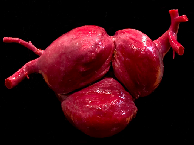 Aortic valve (resin cast)