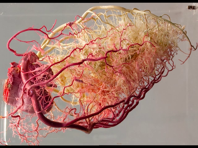 Coronary arteries III (resin cast)