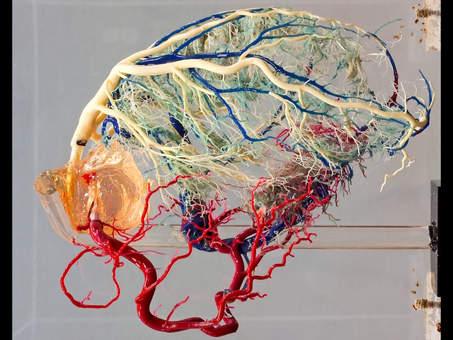 Normal cardiac venous system