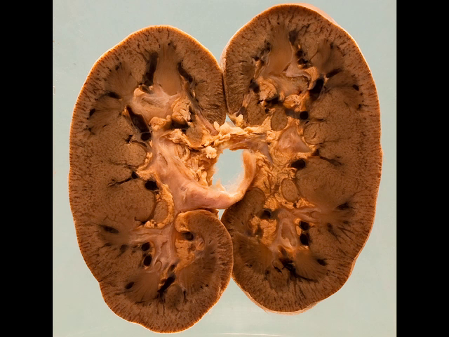 Kidney showing vascular congestion