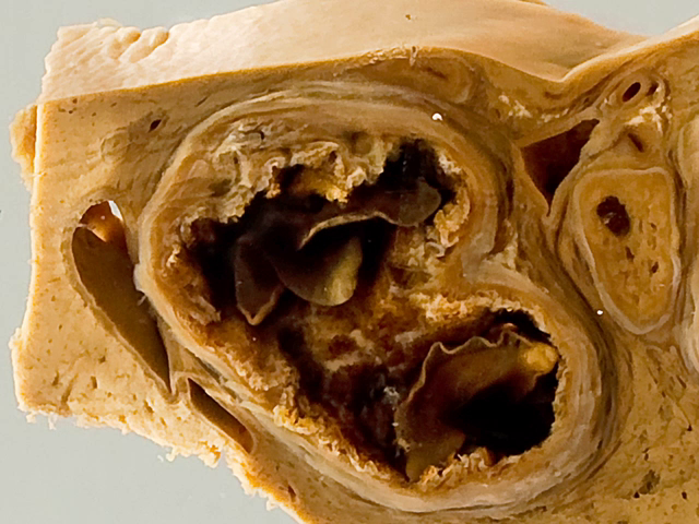 Sheep liver with fascioliasis