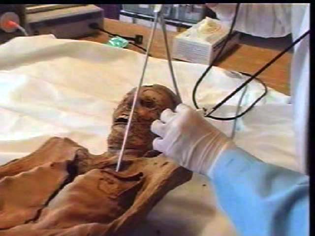 sampling a mummy