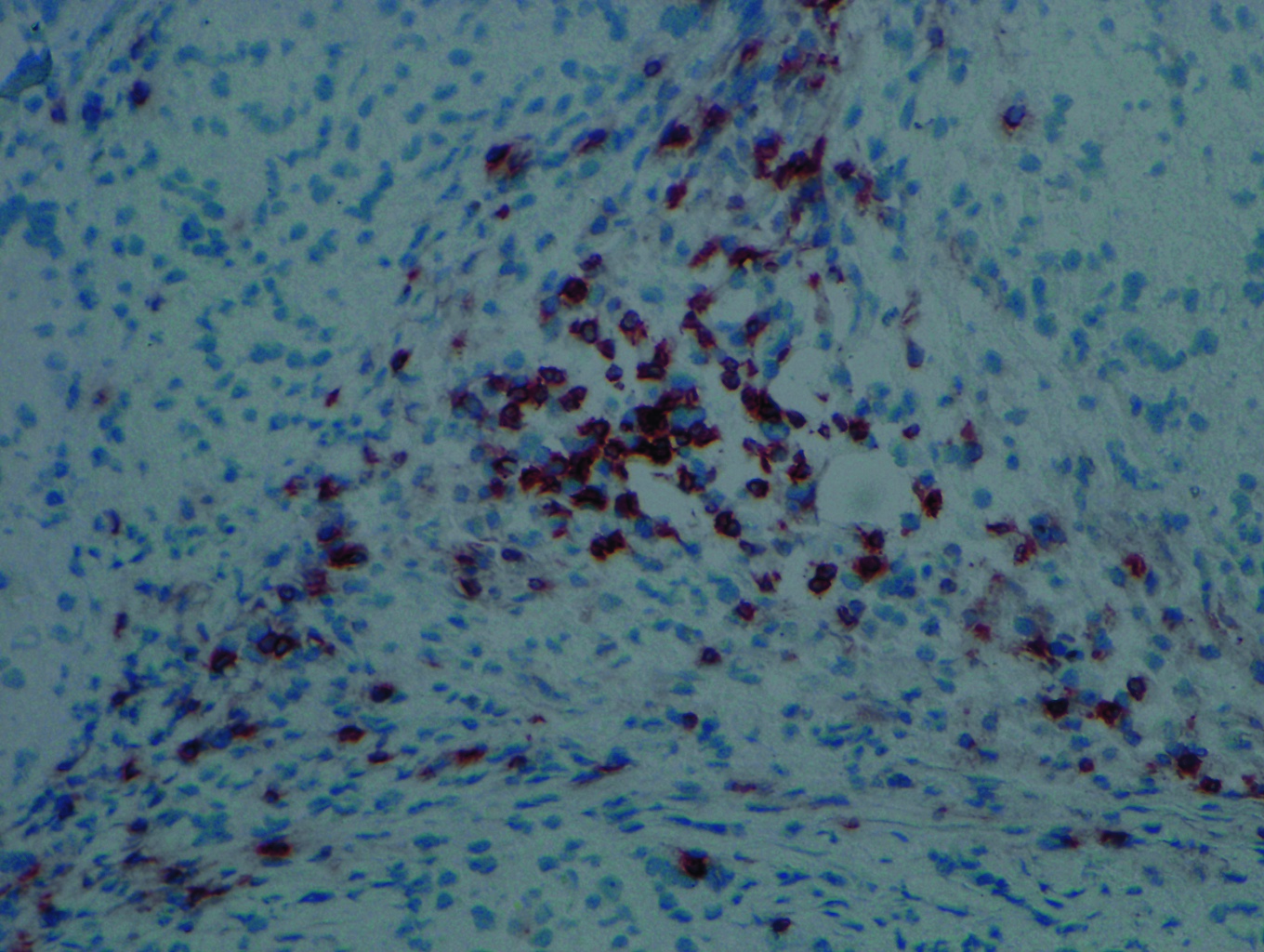 An infiltration of T cells, shown by dark brown colour, can be seen in the tissues formed by iPSCs.