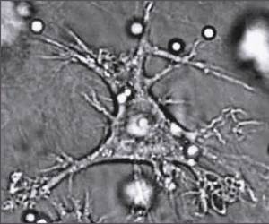 A Dendritic Cell